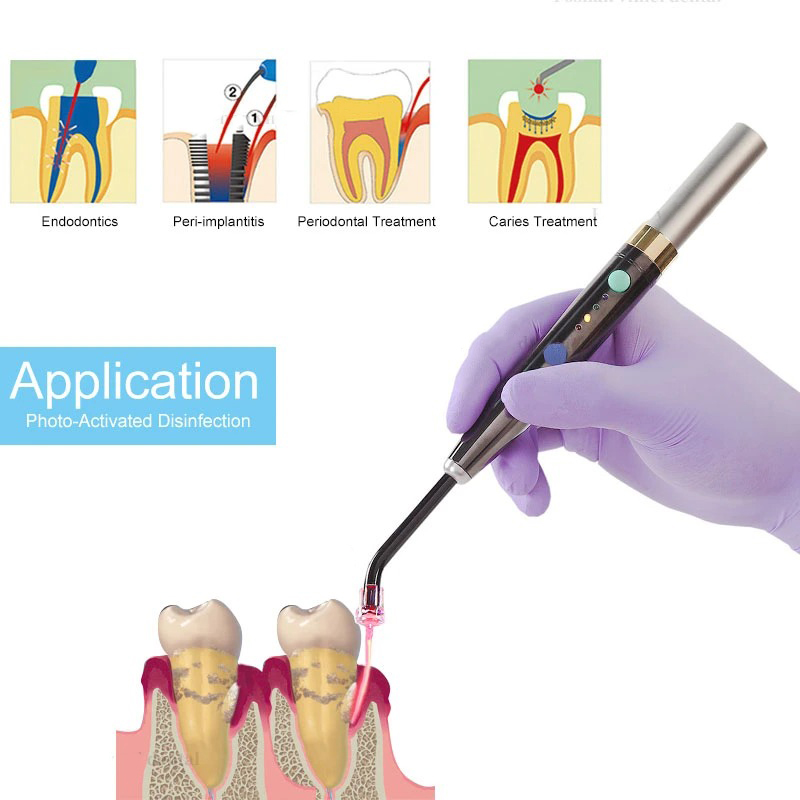 Wireless F3WW Dental Diode Las - Spirit Level ulasan dan harga